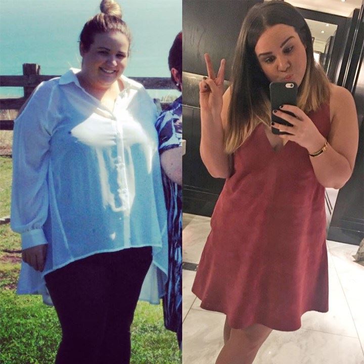 kate-28er-story-01-lost-45kgs-before-and-after-sam-wood