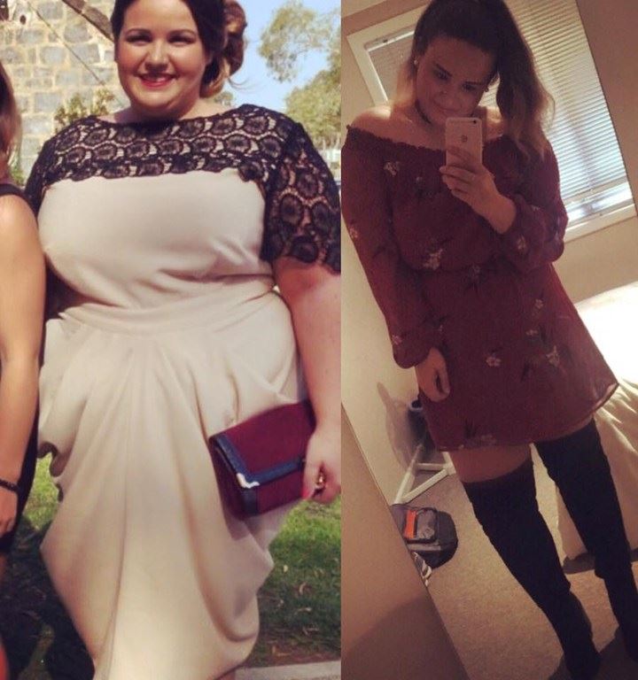 kate-28er-story-02-lost-45kgs-before-after-photo